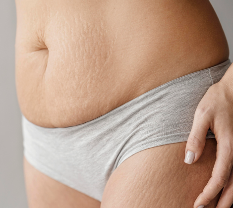 Laser Skin Rejuvenation